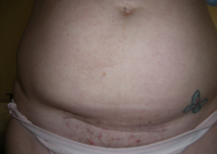 Ů���ʸ�����Ķ�Ƥ �Ҳ��̶�